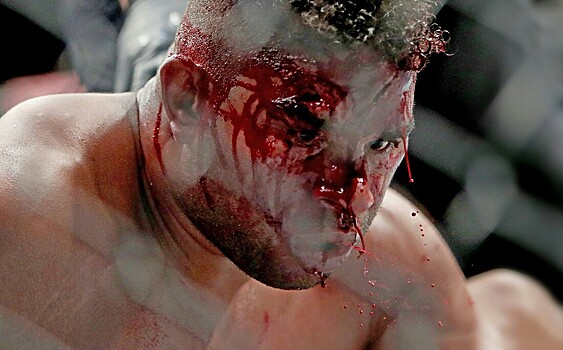 Боец UFC «станцевал локтями» на лице соперника. Последствия ужасают