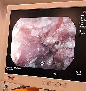 В Оренбурге двухлетний ребенок выпил чистящее средство для кухни. Мальчика удалось спасти