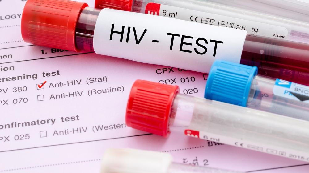 За два месяца в Вологде зарегистрировано 24 случая ВИЧ-инфекции