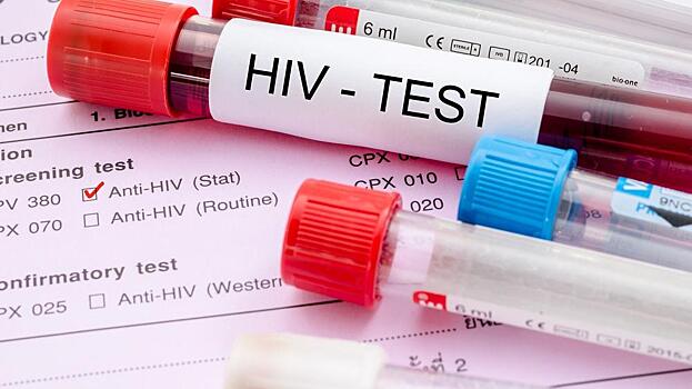 У 28 жителей Вологды обнаружили ВИЧ в этом году