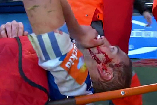 Футболист ударом ногой разбил сопернику лицо