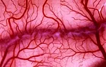 Как кровеносные сосуды "запоминают" инсульт