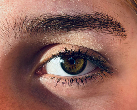 Самарский офтальмолог назвал причины появления аллергического конъюнктивита