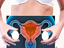 После удаления кисты яичника либидо не изменится