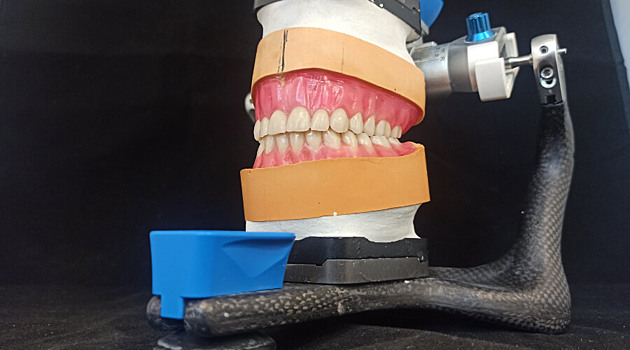 В России готовят создателей киберпротезов и имплантатов