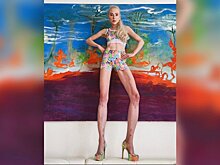 Участница германского реалити-шоу удлинила ноги на 14 см