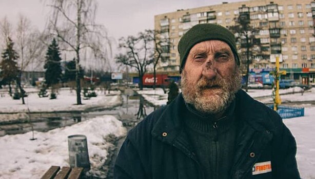 «Сука-жизнь»: инстаграм, привлекающий внимание к проблеме нищеты