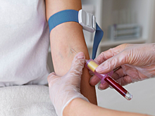 Названы 4 неожиданные причины высокого холестерина — это не еда