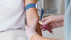 Названы 4 неожиданные причины высокого холестерина — это не еда