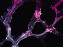 Всего одной наночастицы хватило для лечения рака