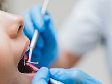 Пензенские ученые изобрели прибор для диагностики заболеваний полости рта
