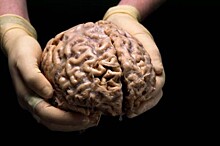 Ученые призвали людей жертвовать свой мозг науке после смерти