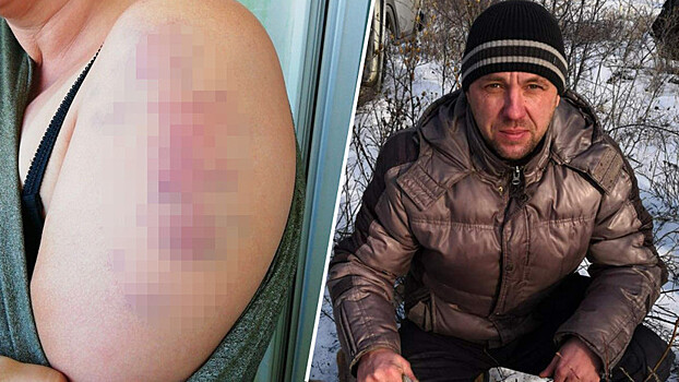 Мать двоих детей из Читы рассказала, как её избивал и запугивал бывший муж