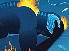 Снимаем боль своими руками