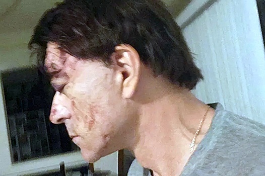 Американские врачи отказались лечить раненного в голову Джигарханяна