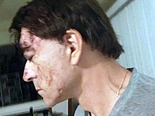 Американские врачи отказались лечить раненного в голову Джигарханяна