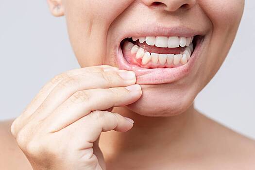 Простая привычка смогла защитить десны от воспаления