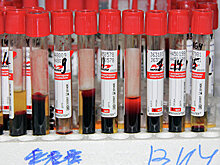 В Москве в апреле 2018 года пройдет шестая конференция по ВИЧ