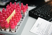 1 813 случаев заболевания коронавирусом выявили в Подмосковье за сутки