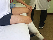 Врачи пришили отпиленную ногу жителю Новосибирска