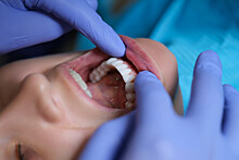 Названы неожиданные причины ухудшения здоровья и внешнего вида зубов