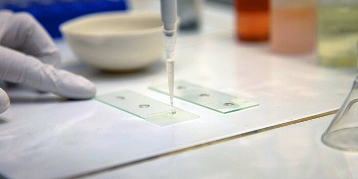 В Беларуси изучают возможность применения стволовых клеток против аутоиммунных заболеваний