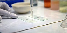 В Беларуси изучают возможность применения стволовых клеток против аутоиммунных заболеваний