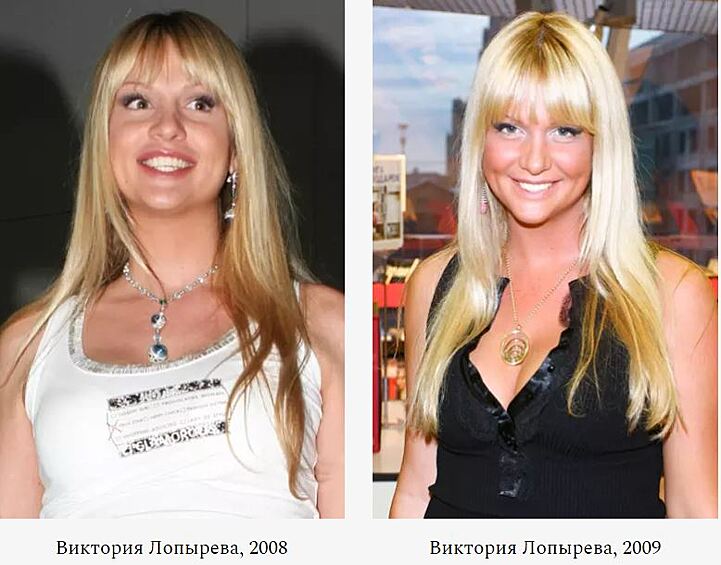 В конце 90-х девушка завоевала свои первые титулы — «Фотомодель Дона», «Лучшая модель Юга России» и «Ростовская красавица». 