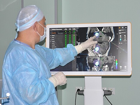Впервые в России: Ростовский онкоцентр применил новую технологию лечения опухолей головного мозга