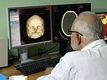 Пензенские врачи первыми в ПФО освоили технологию 3D-протезирования