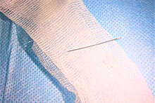 В Чувашии врачи удалили швейную иглу из печени пациентки