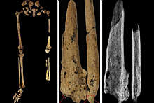 Археологи обнаружили одноногого древнего человека возрастом 30 тыс. лет
