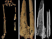 Археологи обнаружили одноногого древнего человека возрастом 30 тыс. лет