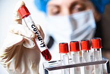 В Астрахани открыли новую лабораторию для тестирования на коронавирус