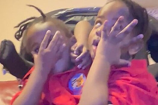 Отец-одиночка сиамских близнецов рассказал о воспитании необычных детей