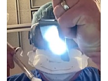 Американский врач показал, что видят больные COVID-19 в тяжелом состоянии