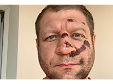 Названо место следующего боя Александра Емельяненко