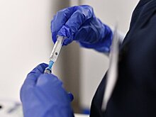 Центр им. Гамалеи может создать вакцину от натуральной оспы за 3–7 месяцев – Гинцбург