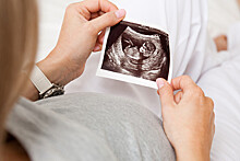 Девочка родилась из 24-летнего эмбриона