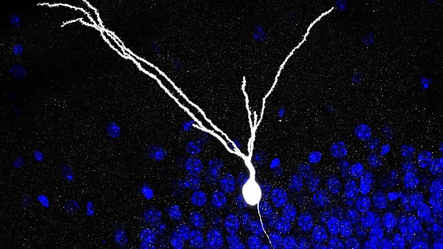 Нейробиологи усомнились в способности нейронов гиппокампа восстанавливаться