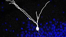 Нейробиологи усомнились в способности нейронов гиппокампа восстанавливаться