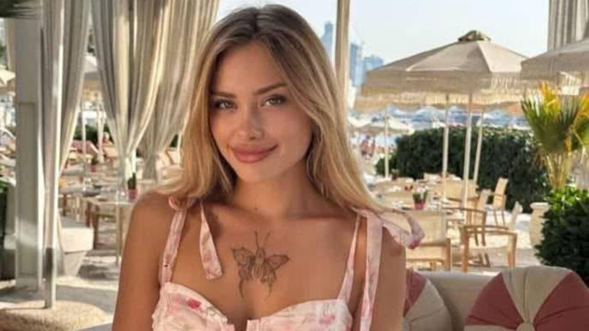 Покалеченная в Дубае модель Ковальчук пришла в себя после операции