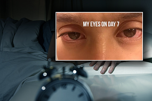 Блогер решил проверить, что будет, если спать 5 часов в день