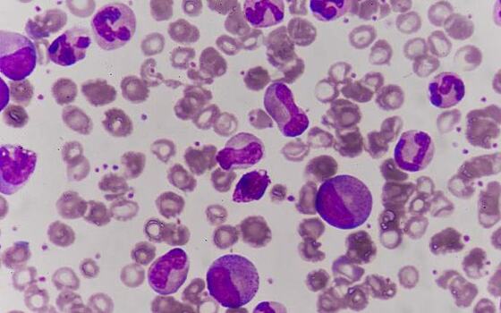 Разработан новый метод синтеза металлических наночастиц в материалах