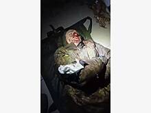 В подвале в Судже нашли брошенного сослуживцами окровавленного бойца ВСУ и сняли на видео