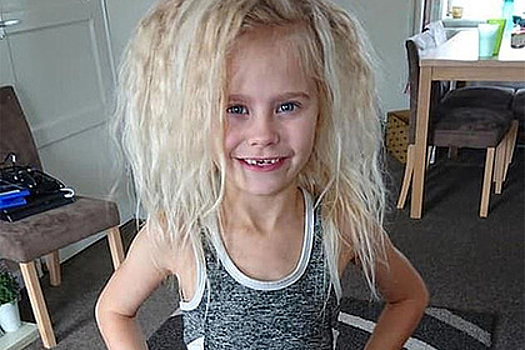 Ребенок не причесывается из-за редкой мутации волос
