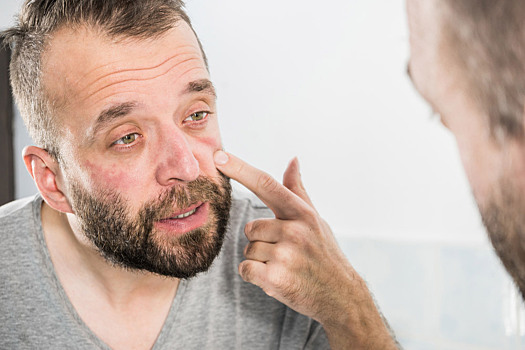 Симптомы каких болезней проявляются на лице