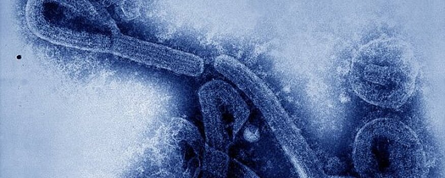 Смертельно опасный для человека вирус выявили в Гвинее