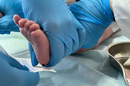 Расширенный скрининг выявил патологии у четырех новорожденных уральцев