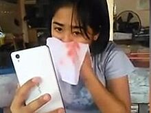В Таиланде девочка "потеет кровью" из-за редкого заболевания